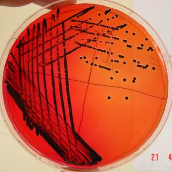 Salmonella